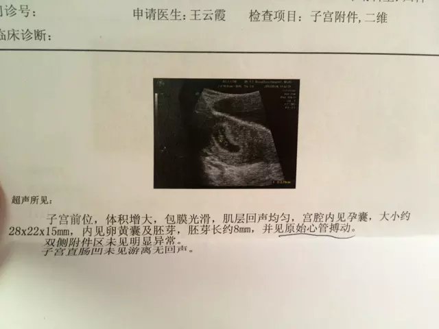 懷孕初期怎麼算男孩女孩：懷孕怎麼判斷是男孩還是女孩