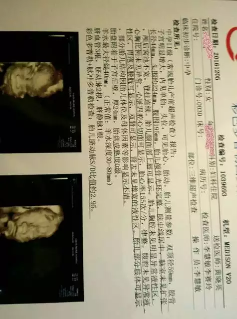 怎麼算懷的是兒子還是女兒：怎麼算懷的是兒子還是女兒