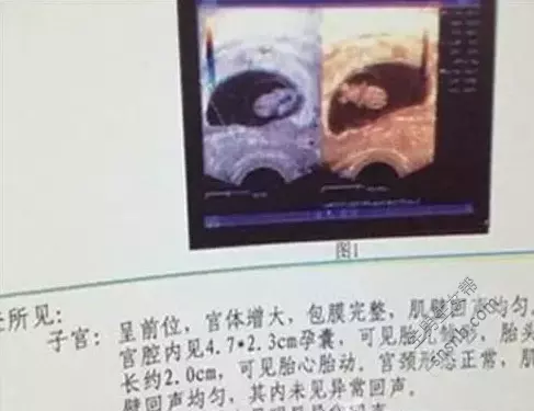 懷孕怎麼查男女最准圖片：怎麼判斷懷男懷女?