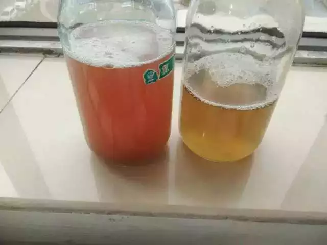 晨尿應該什麼顏色是健康的：怎麼從顏色判斷健康狀況