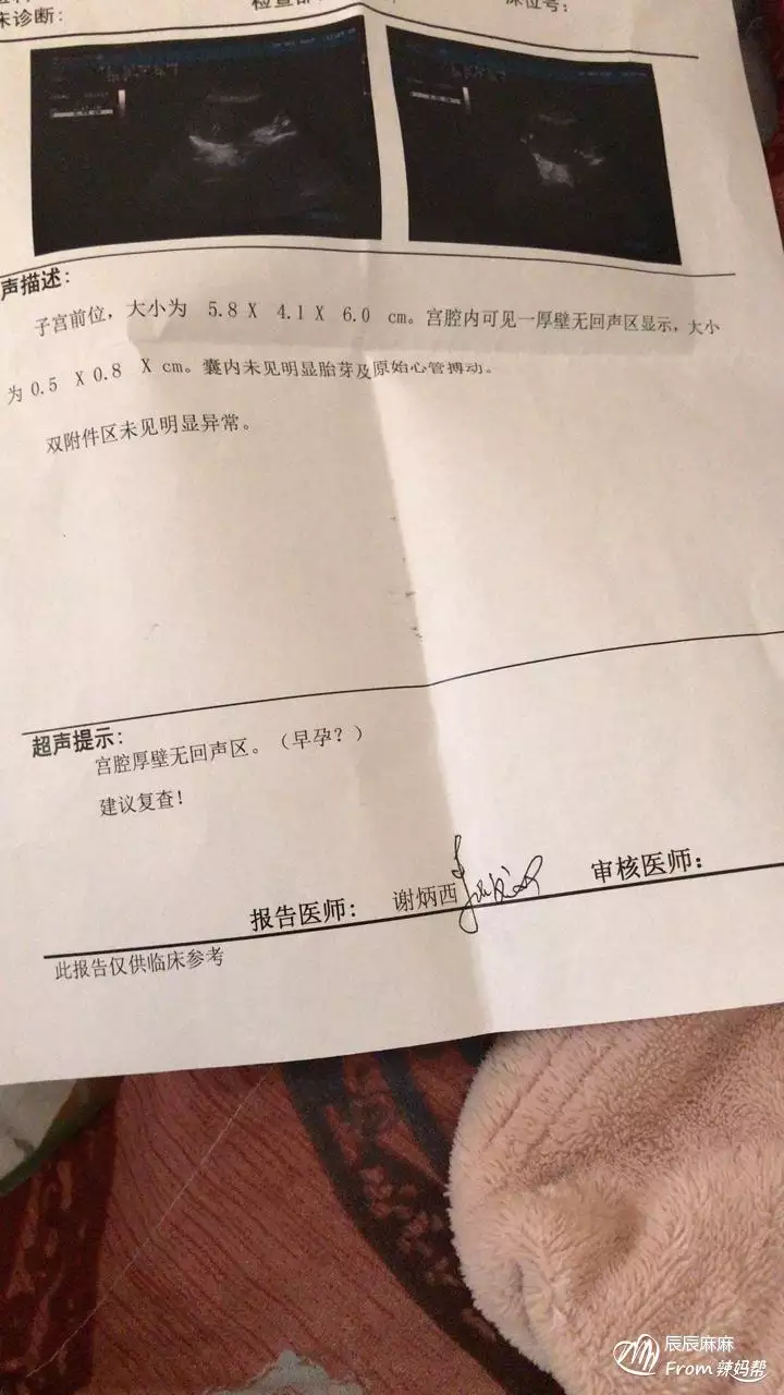 3、我沒結婚，女孩，但是雄性高，大夫告訴我吃！我應該什麼時間吃妥當，吃多久