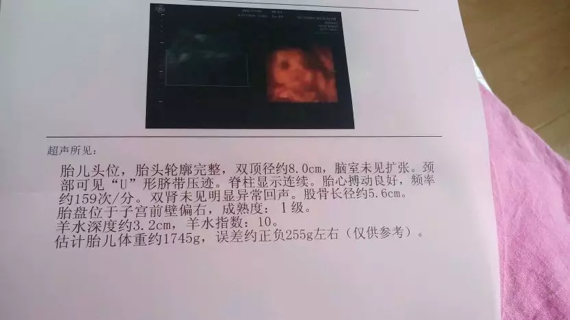 懷女孩有32特徵最准孕期反應：怎樣知道自己懷的是男孩還是女孩