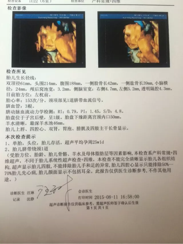 的四維彩超單子數據：四維彩超單怎麼看是男孩還是女孩？