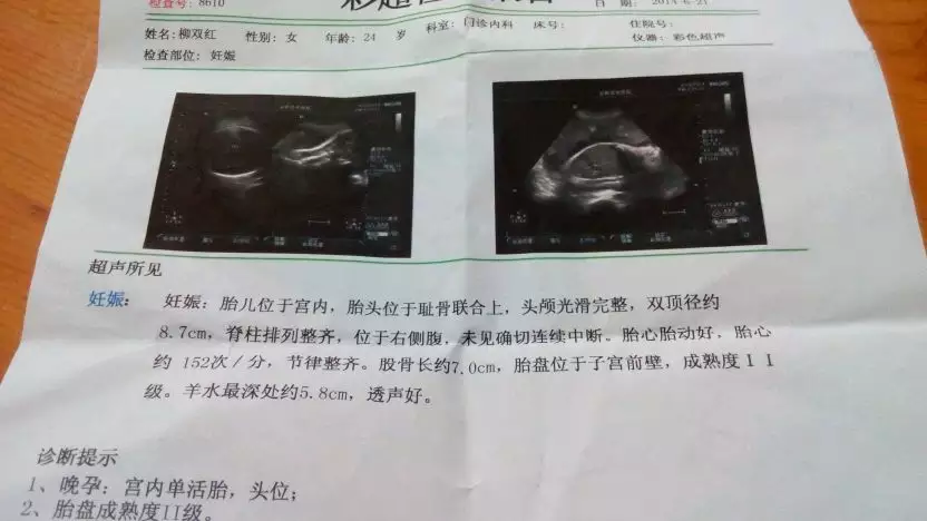 懷孕幾個月能看出男女孩兒B超：B超幾個月可分辨男女？