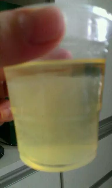酒精如何測試懷孕男女寶寶：酒精測試男女准嗎？有圖片