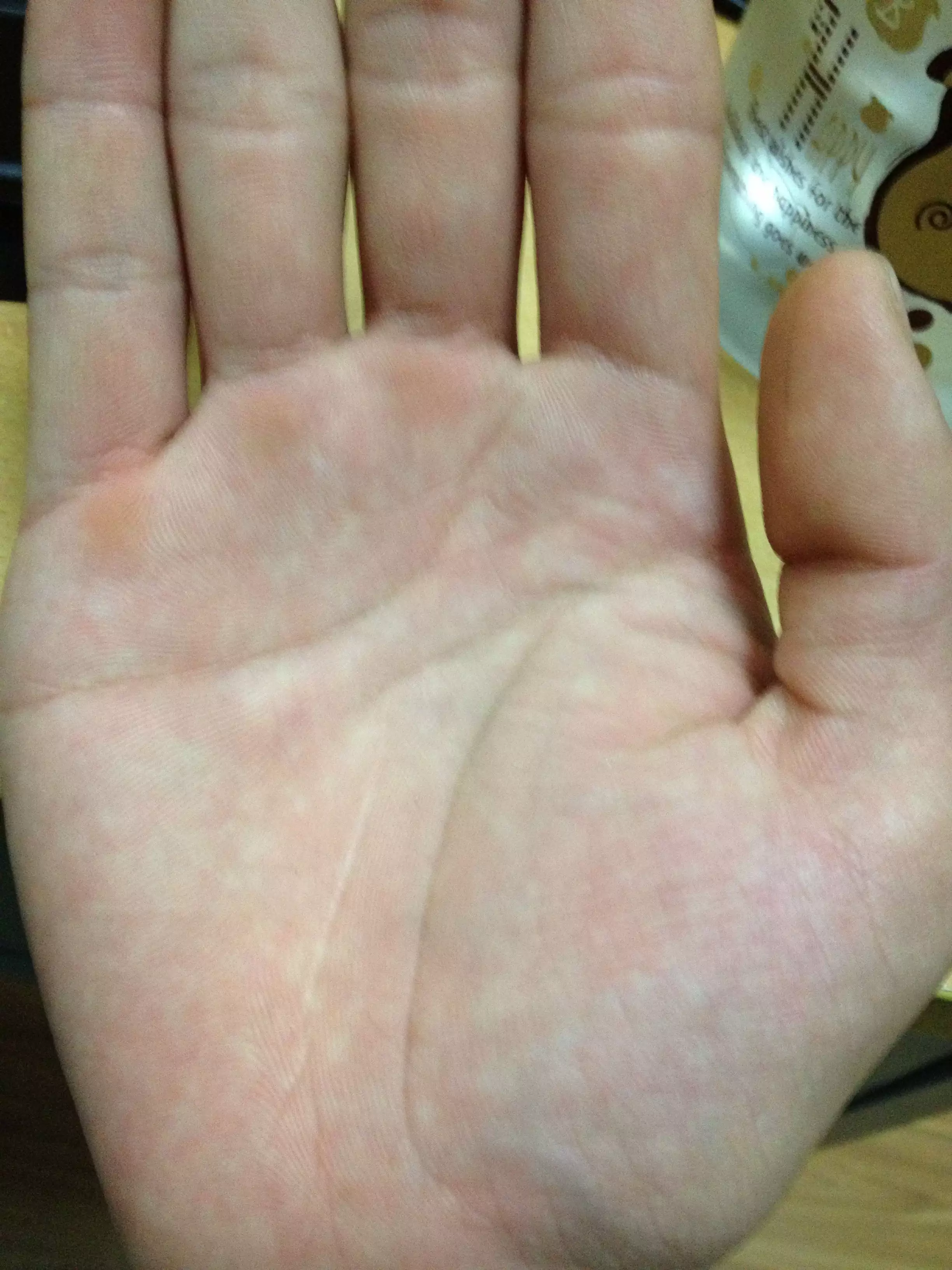 3、她在朋友圈發，掃一掃加一個人就可以免費看手相，只看女孩的手相，這是暗示些什麼。？