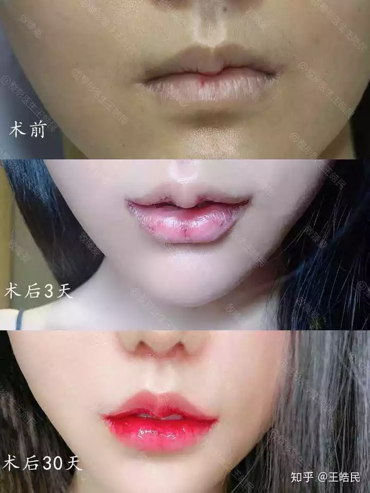3、女人上嘴唇薄下嘴唇厚好嗎:上嘴唇厚的女人命運如何 女人上面嘴唇很厚代表什麼