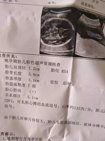 懷孕四個月了，怎麼能看出是男孩還是女孩