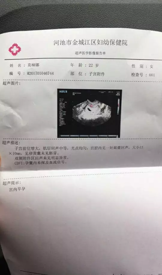 2、九個最准懷男孩徵兆:懷兒子的特徵最準的