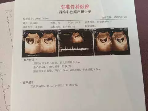 懷孕怎麼能算出來男孩女孩：懷孕生男生女公式計算