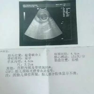 懷孕一個月怎麼查男孩女孩：一個多月怎麼看出男孩女孩