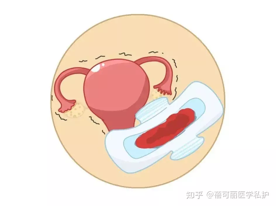 1、夫妻后黴菌感染是怎麼回事:後為什麼會癢怎麼辦?