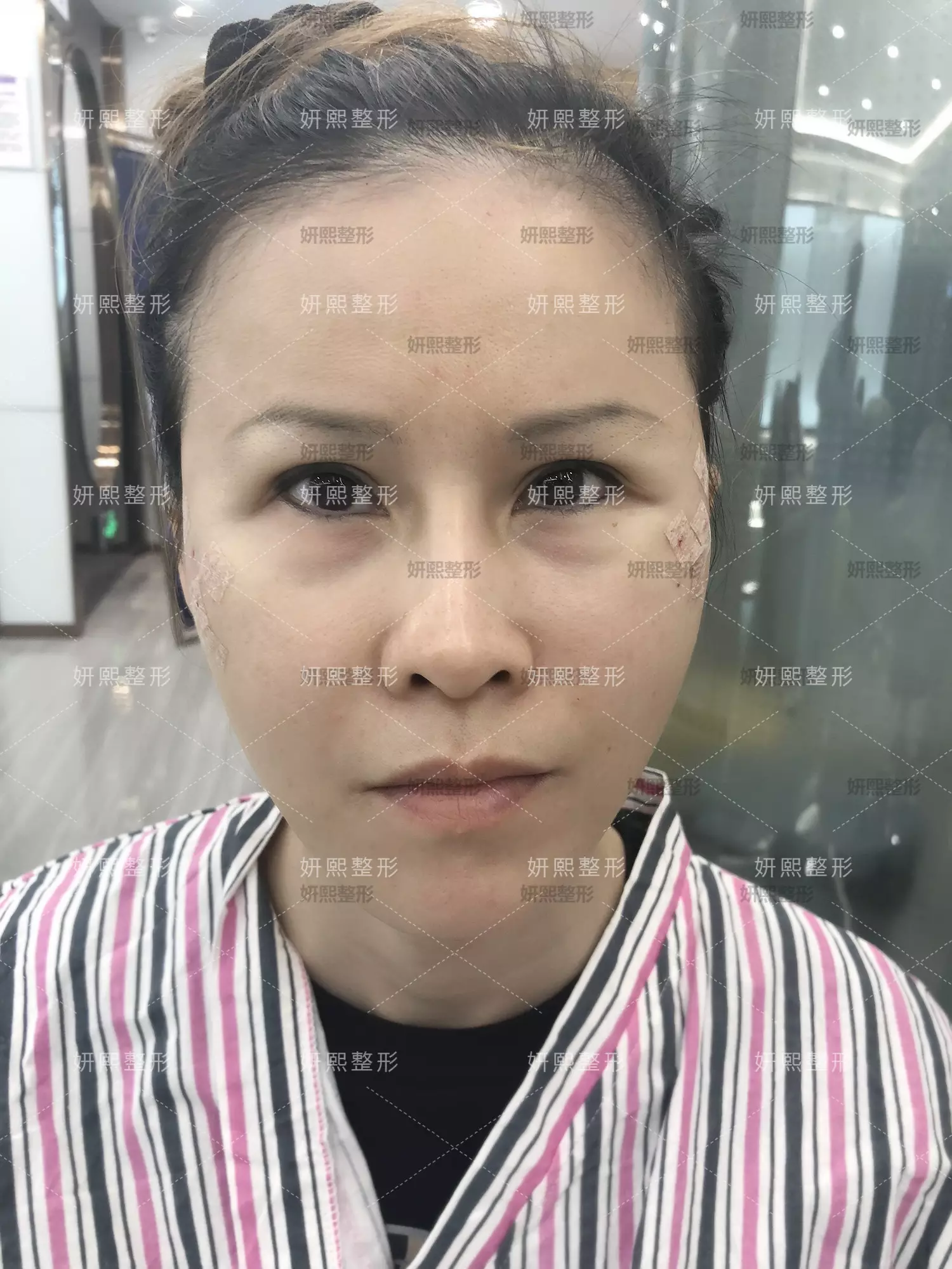 1、人的年齡如何看出來:怎麼看人的年齡？