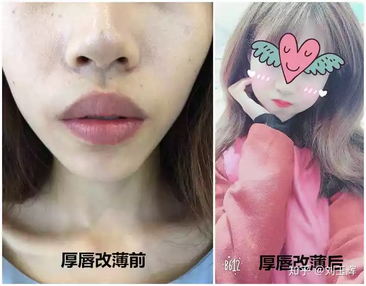 5、女人上唇薄下唇厚代表什麼:女人嘴唇厚說明什麼