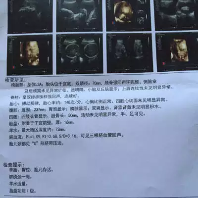 四維單子上藍色是男孩：怎麼從四維檢查單看出是男孩還是女孩
