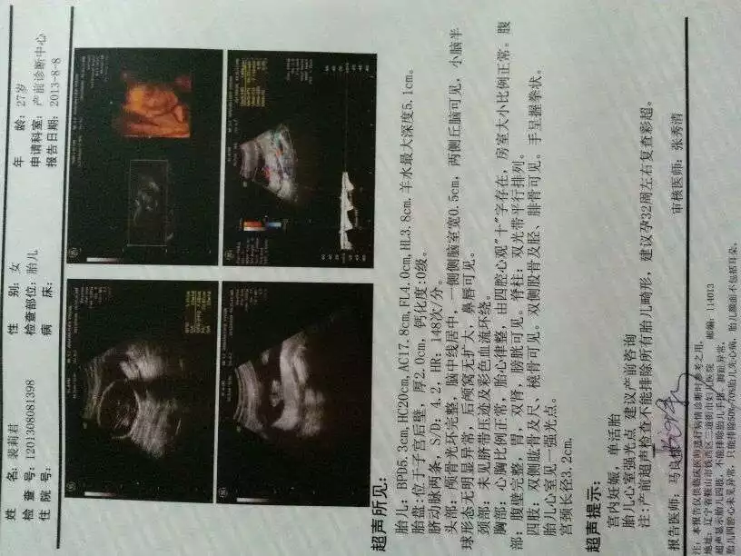 懷孕一個月如何測男女：醫生說挺好的暗示男女
