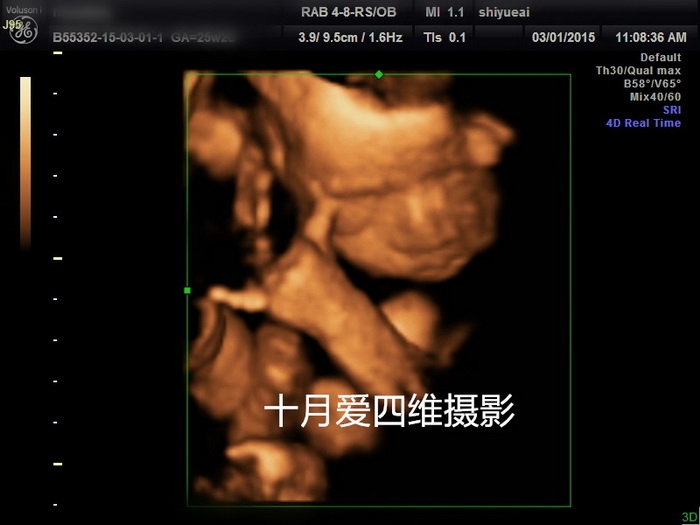 四維彩超右上角的MI是什麼意思：mi|中文什麼意思？