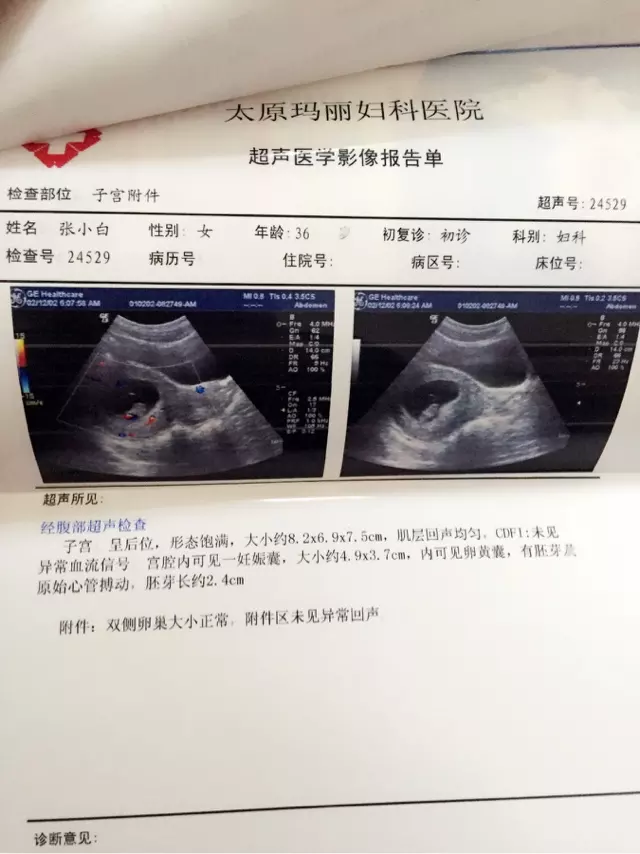 懷孕多久去檢查，才能查出是男孩還是女孩？