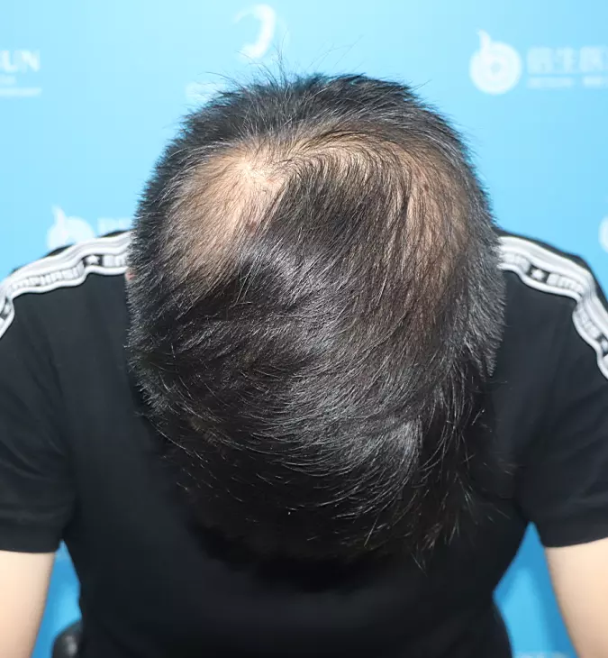 3、人一出生是幾歲:人一出生到底是幾歲，是1歲還是0歲呢？
