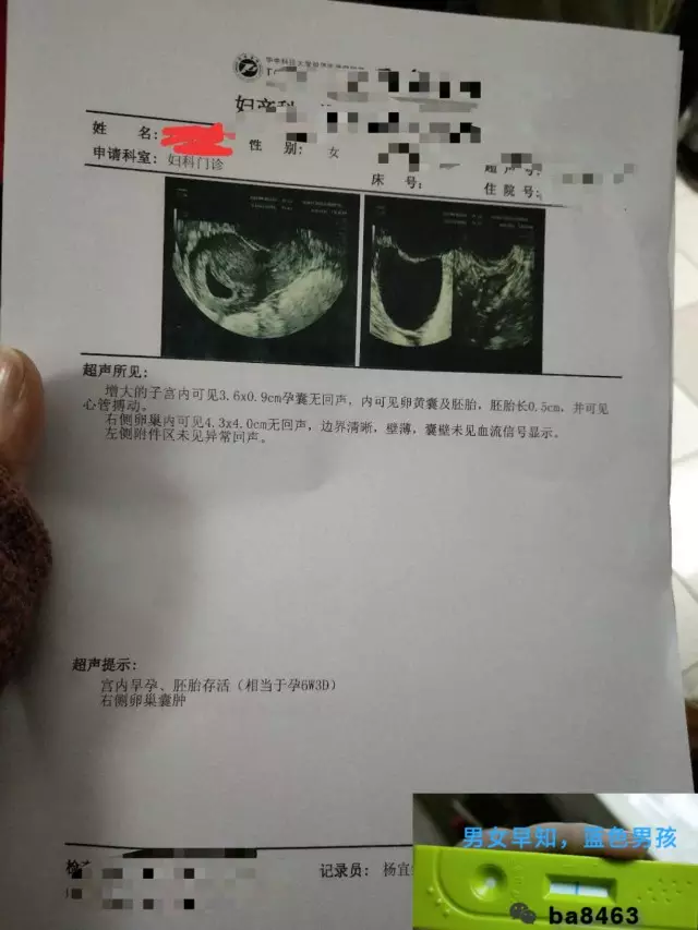 頭胎兒子二胎女兒徵兆：頭胎兒子二胎女兒