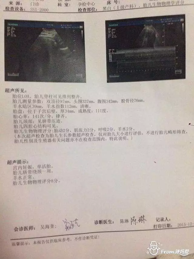 除了b超還有什麼辦法測男女：除了做B超，還有什麼辦法判斷男女