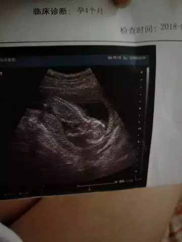 懷孕幾個月能看出男孩兒女孩兒：有生女秘方嗎?