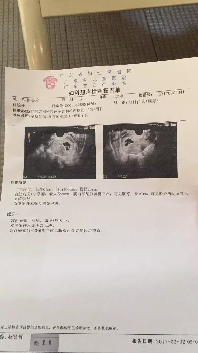 6周孕囊只有抓拍的2個數據，孕囊大小為×是男是女