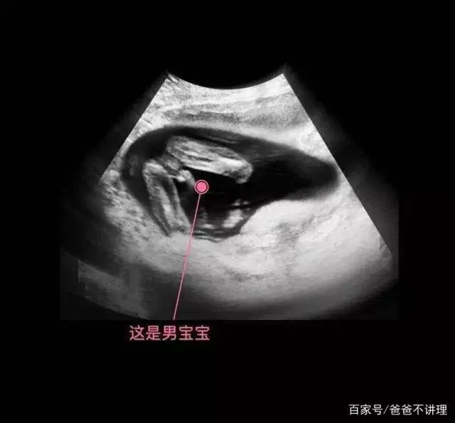 1、10秒測出懷男孩和女孩:怎樣辨別自己懷男孩和女孩