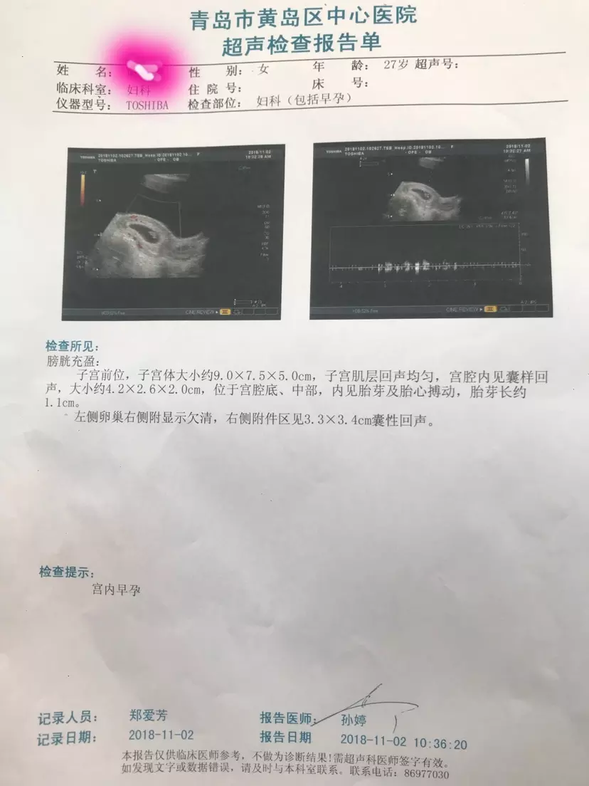 已生女孩孕囊圖片早期：孕囊什麼時候看形狀最准