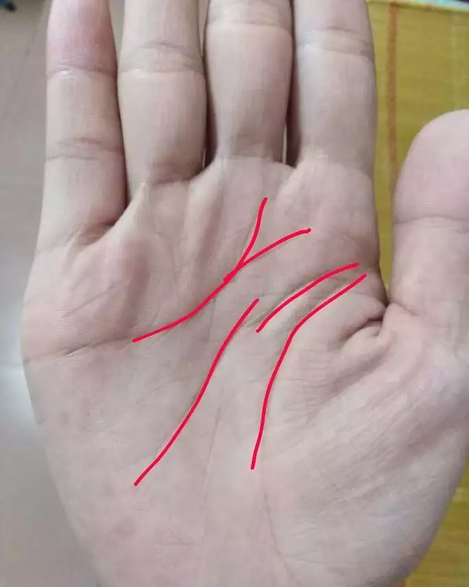 2、手上的姻緣線是哪一根:男左手二條婚姻線，右手一條婚姻線，婚姻解釋