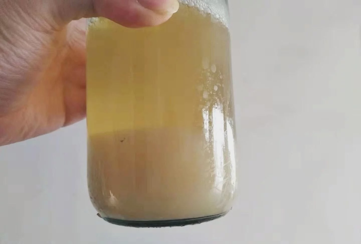 懷孕后尿的顏色有什麼變化：懷孕后的是什麼顏色