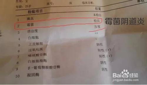 3、和老公就複發黴菌:為什麼黴菌性炎總是複發，反反覆復的好煩人