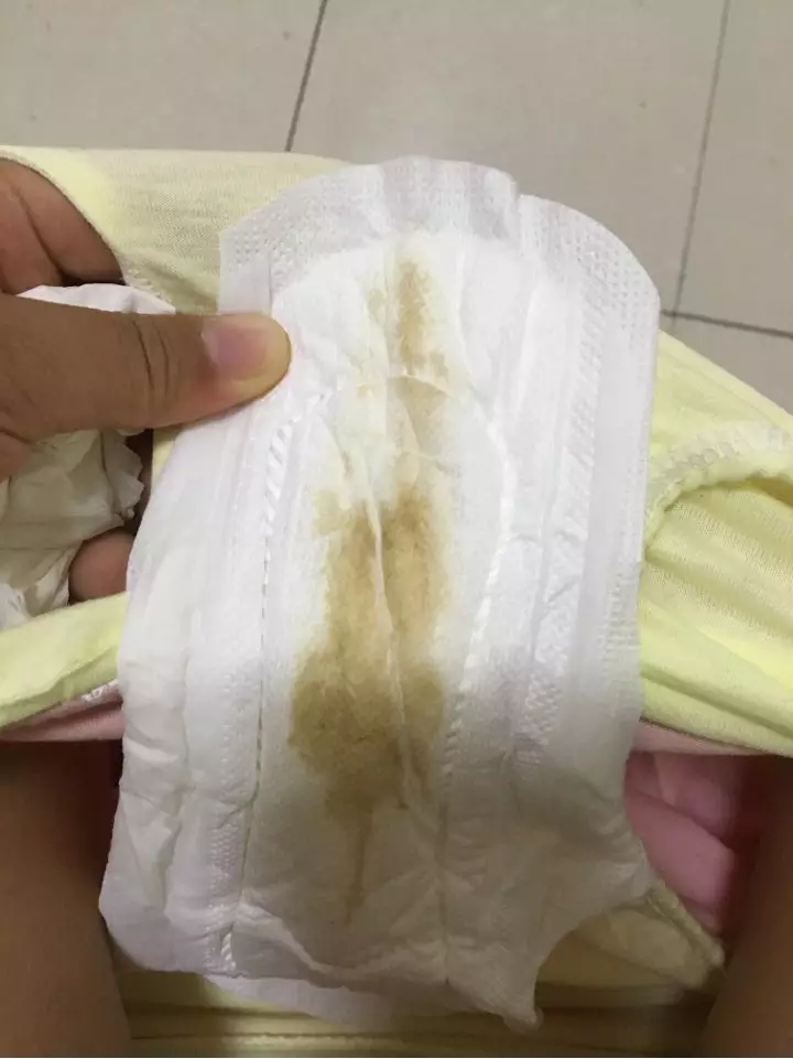 加醋變紅是懷孕圖：懷孕測男女用尿和醋