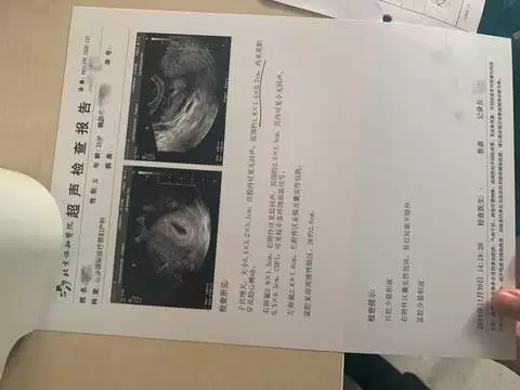 怎樣自測是宮外還是宮內孕：懷孕幾周應該去醫院檢查排除呢