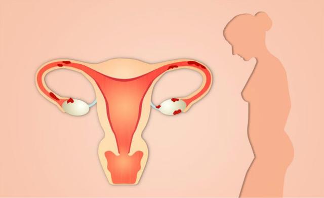 2、啥時候容易生閨女:女生是什麼時候？