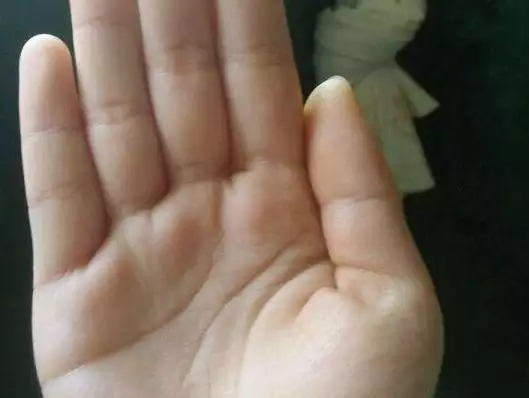 6、感情婚姻不順的手相:婚姻不順，手相如何女