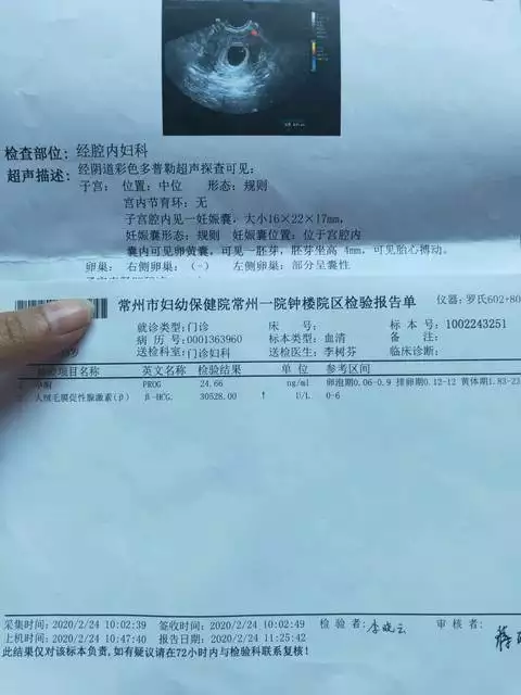 長孕囊和圓孕囊的區別圖片：孕囊茄子狀真的就是男孩嗎