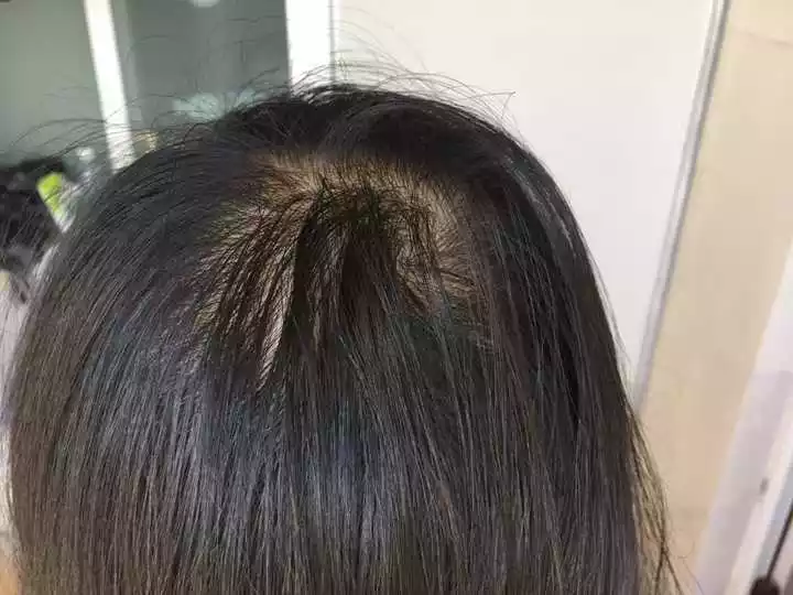 屬相不合纏孝會沒頭髮嗎：用頭纏玉燒不斷的就是真玉嗎