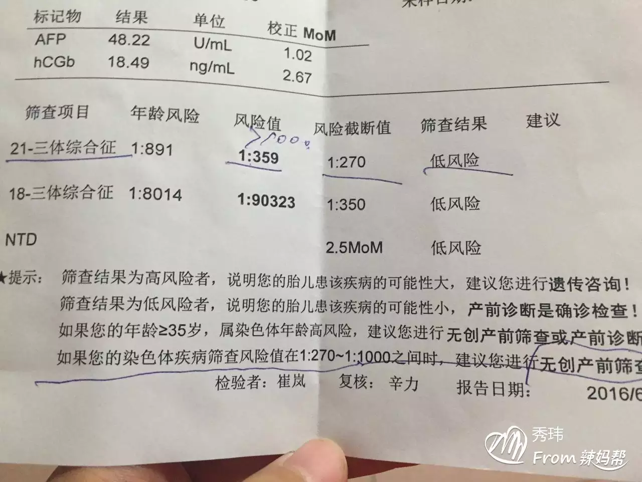 2、無創18看男女已生驗證:無創DNA順利通過，有會從結果看男女的嗎