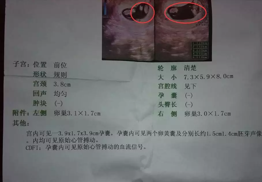 懷孕怎樣能看出懷的是男孩女孩：懷男孩初期有什麼感覺