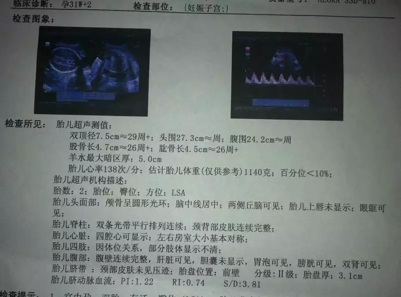 四維彩超右上角數據解讀：四維彩超圖片右上方的m和f什麼意思