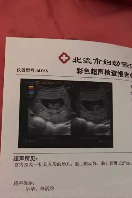 大寶頭旋暗示下一胎性別：有些老人說從大寶的長相能看出二胎性別，科學嗎？
