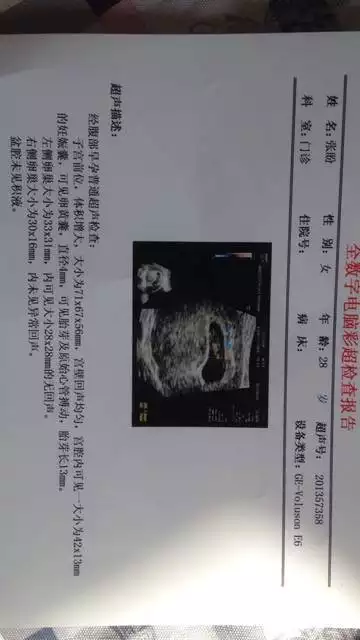 哪種孕囊屬於茄子型圖片：孕囊大約××是圓形還是茄子形？