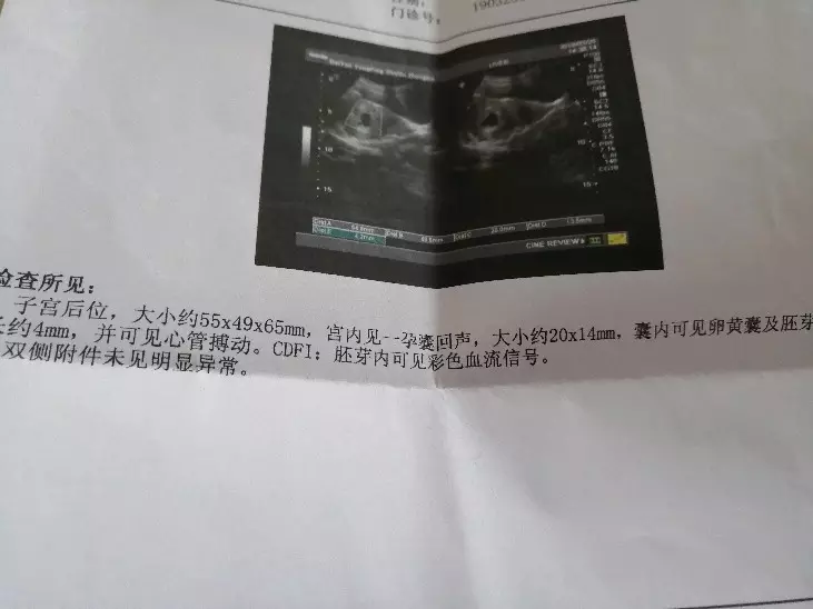 二胎看男女最準的方法：年幾月生男孩