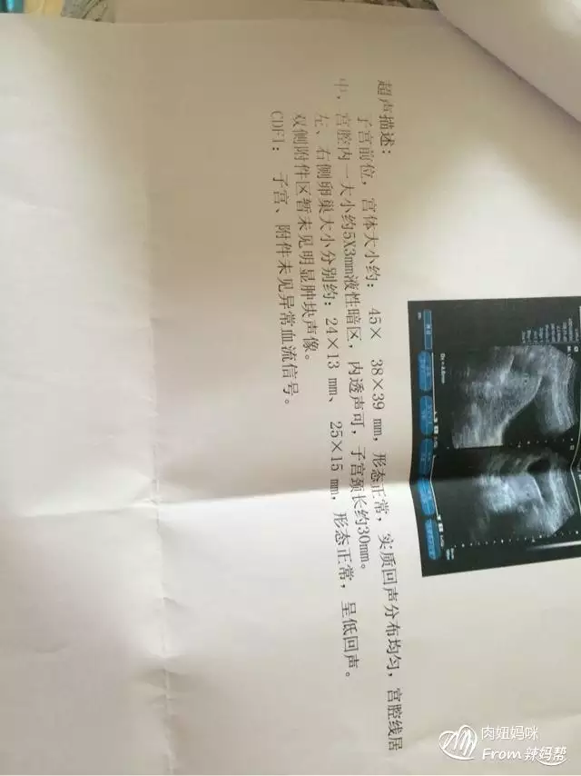 孕早期最快判斷宮內孕：怎樣判斷腹痛是