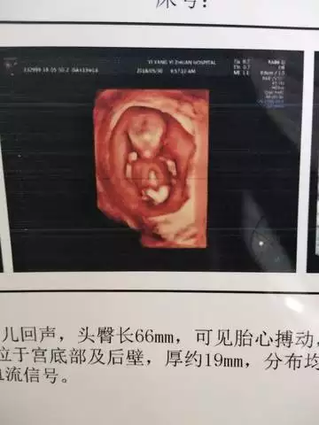 3、NT三個亮點是男孩女孩:nt辨別男女真的准嗎？