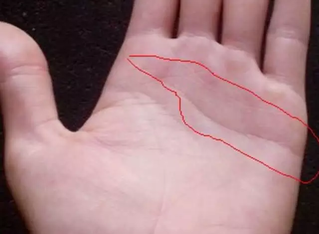 5、女生的婚姻線怎麼看:哪位能會手相，看一下我的婚姻線！我是女生