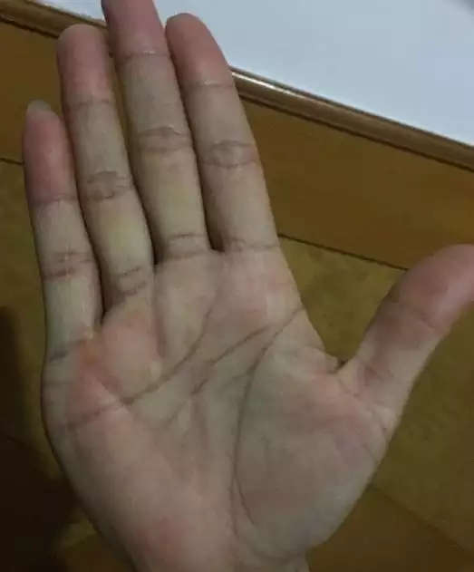 3、川掌女和斷掌男的婚配:斷掌的男人和川字掌掌的女人配嗎？如題 謝謝了