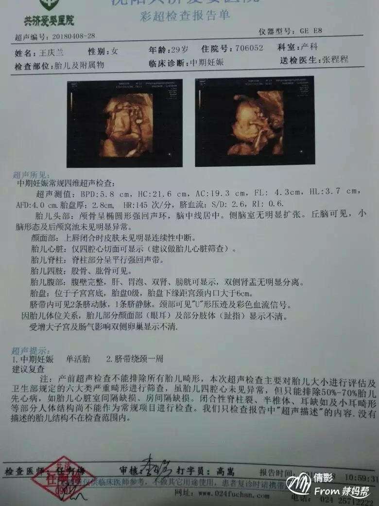 四維單子看男孩女孩訣竅：四維彩超單子24周的，看男女，答對有獎