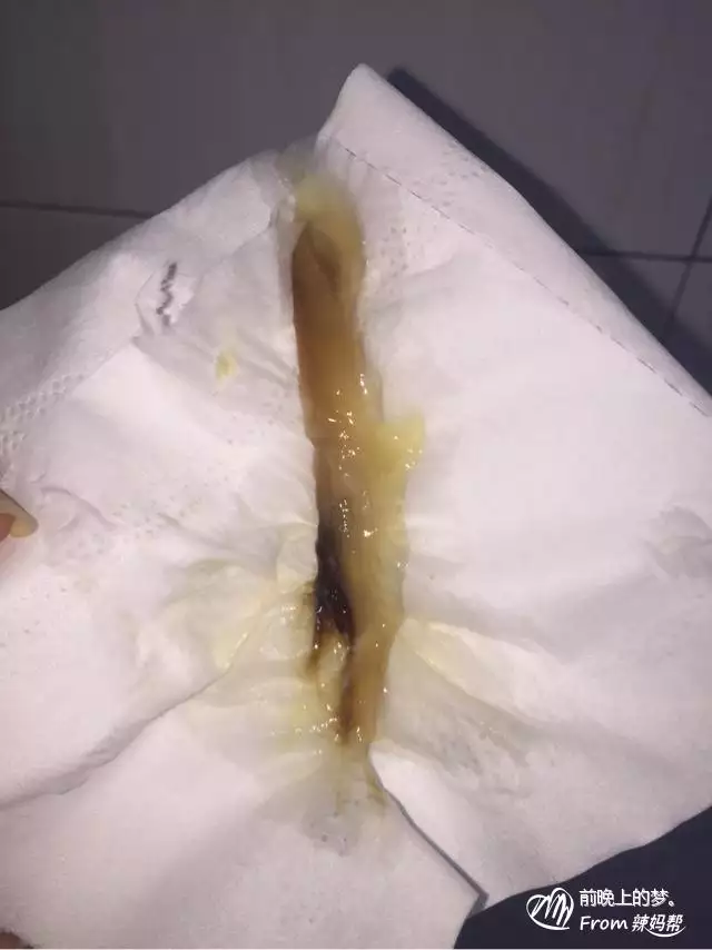 懷孕物多是男孩女孩：懷孕前期物會不會多